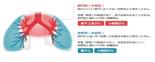 肺がん検査